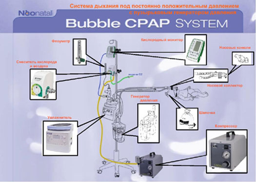 Система CPAP-терапии Bubble CPAP System без компрессора/ с компрессором фото Система CPAP-терапии Bubble CPAP System без компрессора/ с компрессором